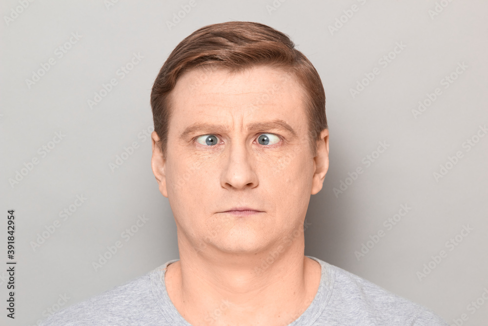 Portrait of funny confused man with with crossed eyes Portrait of funny confused man with with crossed eyes