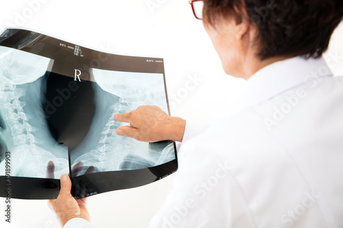 The orthopedic doctor is pointing out the lesions of the spine photo