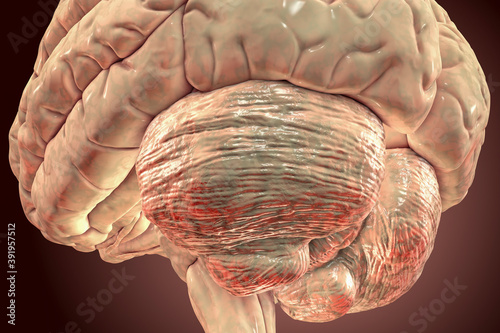 Human brain with highlighted cerebellum photo