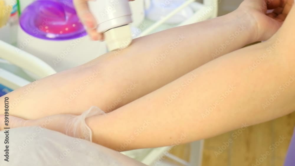 A master beautician applies a special composition of warm wax to a woman's hand using a cartridge. to remove unwanted forearm hair. She prepares for the epilation procedure. A master beautician applies a special composition of warm wax to a woman's hand using a cartridge. to remove unwanted forearm hair. She prepares for the epilation procedure.