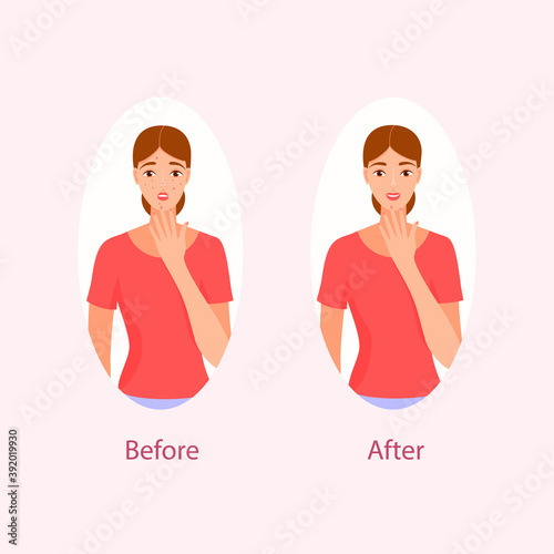 acne treatment before after cartoon illustration