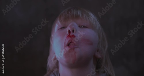 blond boy covered in blood. child has weak vessels in nose, bursting with pressure drops and changes in weather. Hemophilia disease.  kid raises her head to stop bleeding photo