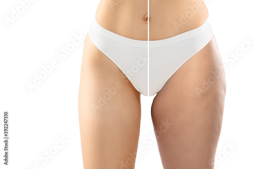 Overweight woman with cellulite legs and belly in white underwear comparing with fit and thin body isolated on white background. Orange peel skin, liposuction, healthcare, beauty, sport, surgery.