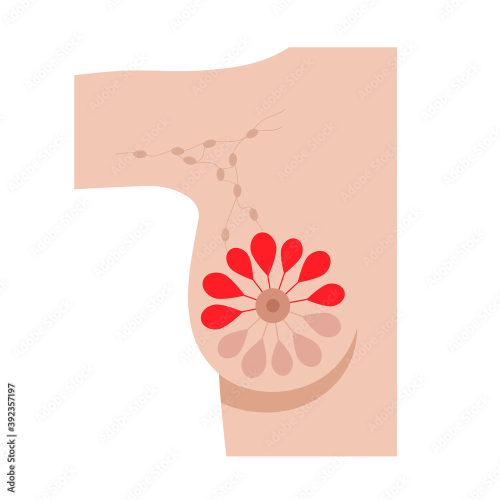 Obraz premium Breast disease concept