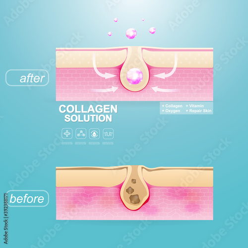 Collagen Solution Serum Drop and Vitamin Background Skin Care Cosmetic concept.