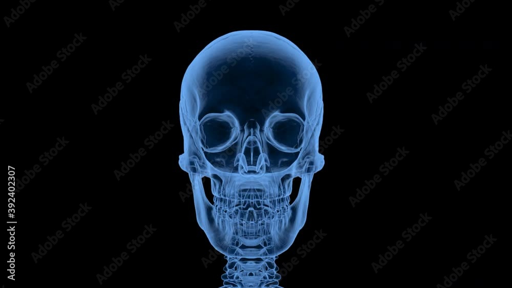 x-ray human skull x-ray human skull