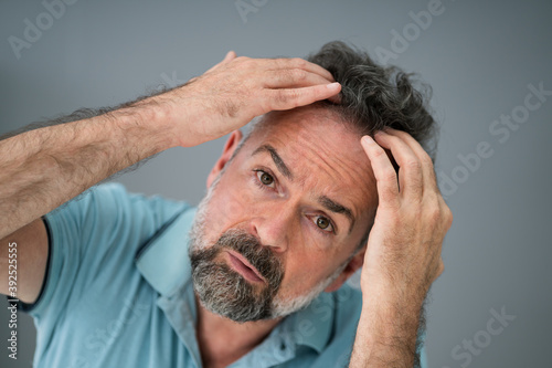 Man Checking His Hair Loss