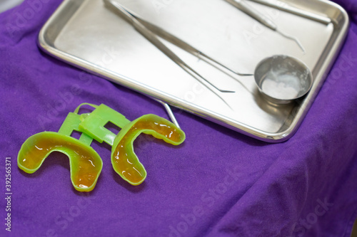 dentist filling fluoride into mouth guard to do treatment for kid at dental clinic