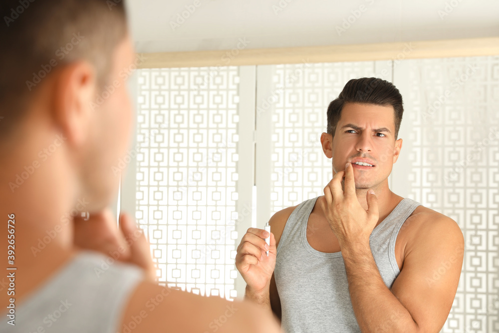 Emotional man with herpes applying cream on lips in front of mirror at home Emotional man with herpes applying cream on lips in front of mirror at home