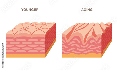 Skin cross section. Younger and aging. Smooth and wrinkled. Pale colored illustration. 