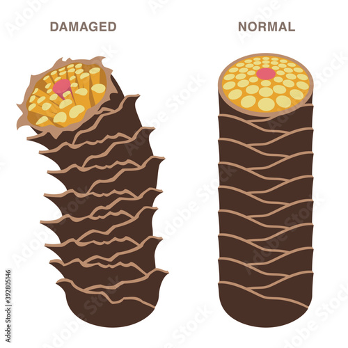 Normal and damaged hair. Smooth and damaged cuticle. Pale colored illustration. 