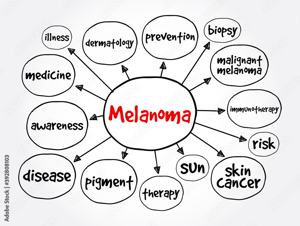 Melanoma mind map, concept for presentations and reports