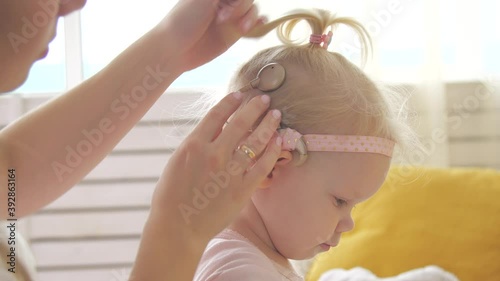 Concept of hearing impairment and their treatment. Mom connects a cochlear implant for her daughter photo