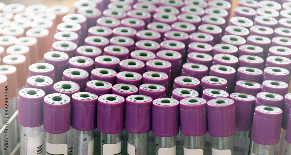 Obraz premium Closeup view of blank plastic blood tube, blurred background.