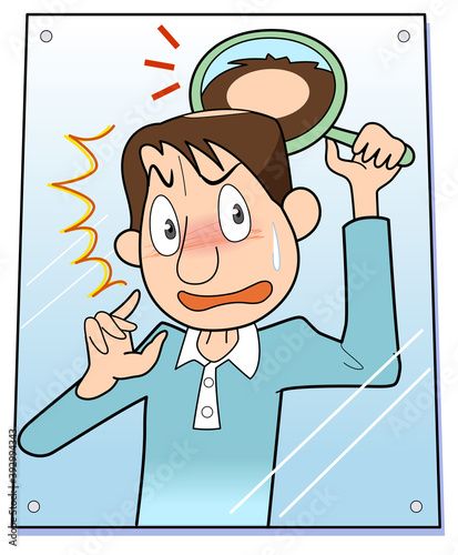 頭頂部が禿げる