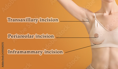 Fotografi Young woman with different types of incisions for breast augmentation on color b