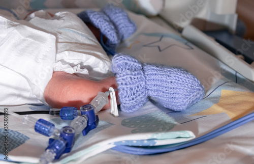 Premature newborn recovering in incubator. His foot in a blue sock with an infusion system in focus. Neonatal intensive care unit.