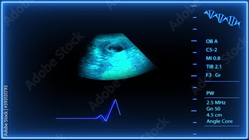 Ultrasound ,Sonogram Procedure to healthy baby or fetus development and pregnancy. 
Futuristic Medical Baby Ultrasound in blue tone hospital gravid pulse screen. X-ray