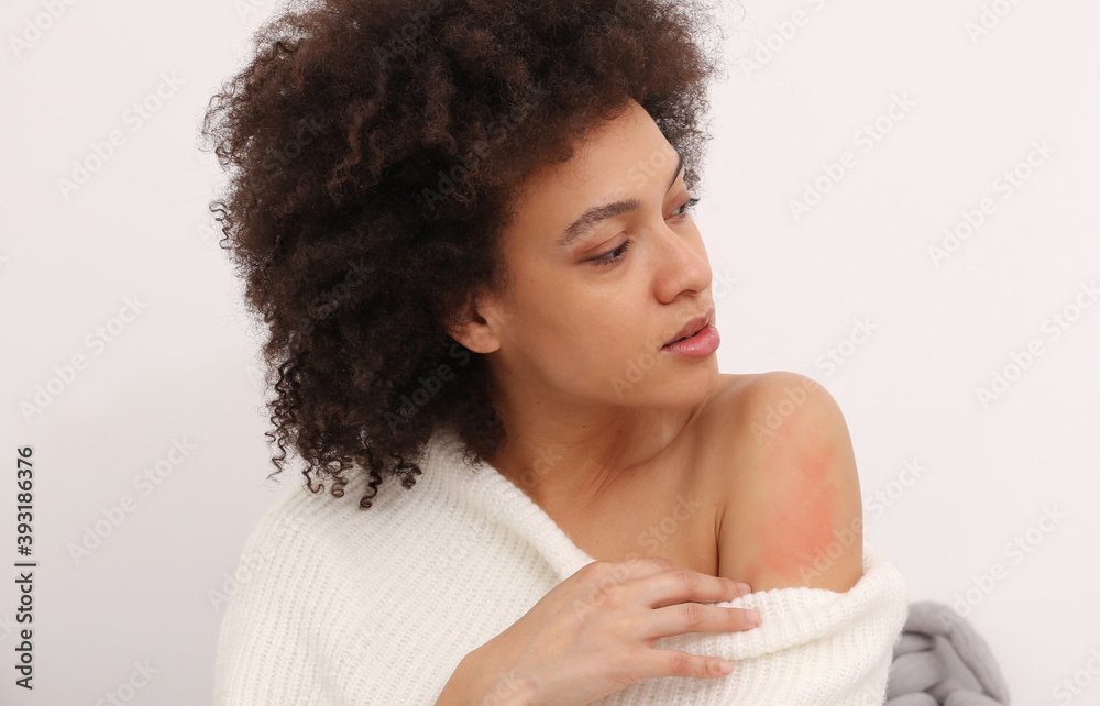 Woman Scratching an itch . Sensitive Skin, Food allergy symptoms, Irritation Woman Scratching an itch . Sensitive Skin, Food allergy symptoms, Irritation