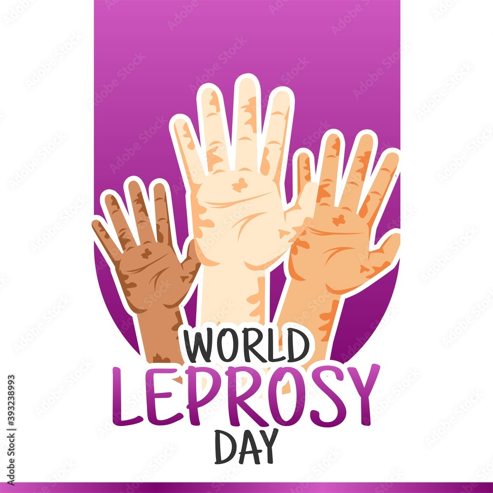 Obraz premium World Leprosy Day Vector Illustration. Suitable for greeting card poster and banner