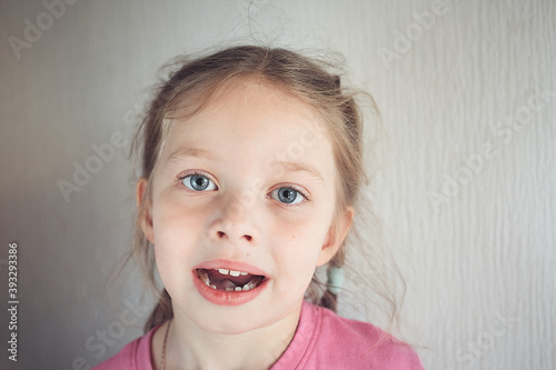 first baby teeth that fell out, portrait of a girl with her front teeth that fell out, children's dentistry photo