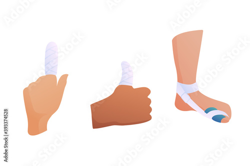 Set of illustrations of fractures of fingers and toes on a white background. Bandage on the fingers of human limbs. The concept of first aid to the victim.