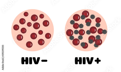HIV in the blood. blood with and without HIV. blood of a person infected with HIV. blood under a microscope. World aids day. vector illustration