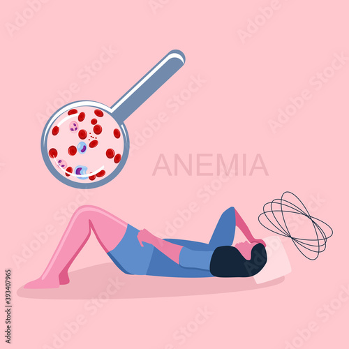 Woman is laying on her back and feeling tired, weakness because of Iron deficiency in serum.Anemia concept.Decrease of Erythrocytes or low hemoglobin.Magnifying glass with blood analysis.Pink.Vector