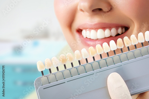 Smiling young woman. Cosmetological teeth whitening in a dental clinic. selection of the tone of the implant tooth photo