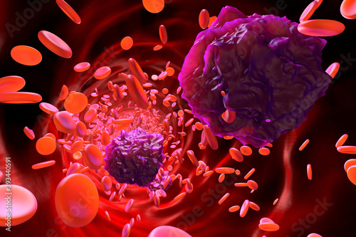 3D rendered Illustration of Leukemia cells in the blood stream photo