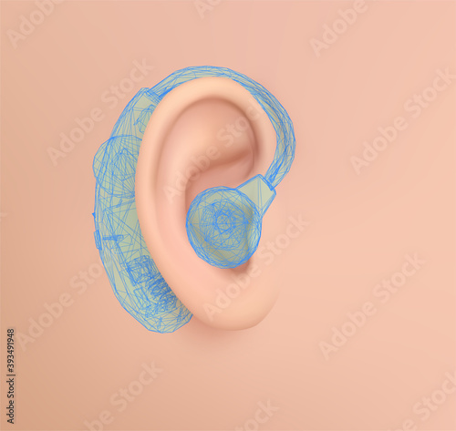 vector human ear. hearing treatment, plastic surgery, implantation