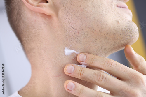 Fototapeta Naklejka Na Ścianę i Meble -  Man's neck with stubble and shaving cream. Men's shaving and skin irritation concept