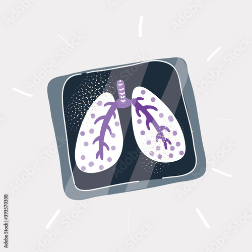 Vector illustration of Closeup shot of young man holding x-ray of lungson white backround.