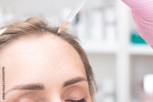 inject with a syringe into the hair roots for regeneration. Stimulates hair growth. PRP therapy process. hair loss problem
