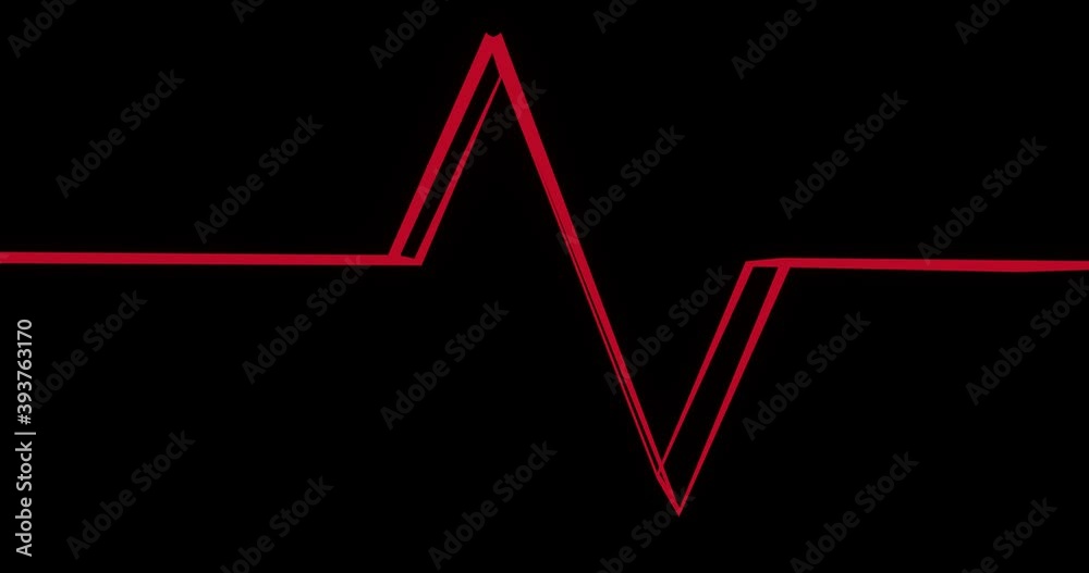Red Blood pulse sign animation design with stylized emission. Emergency room vibe indicating human health condition. Pulsing lines Red Blood pulse sign animation design with stylized emission. Emergency room vibe indicating human health condition. Pulsing lines