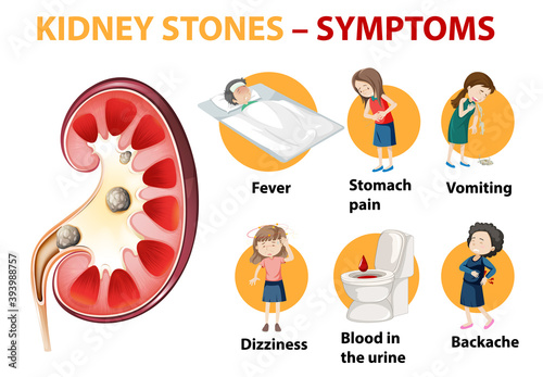 Kidney stones symptoms cartoon style infographic