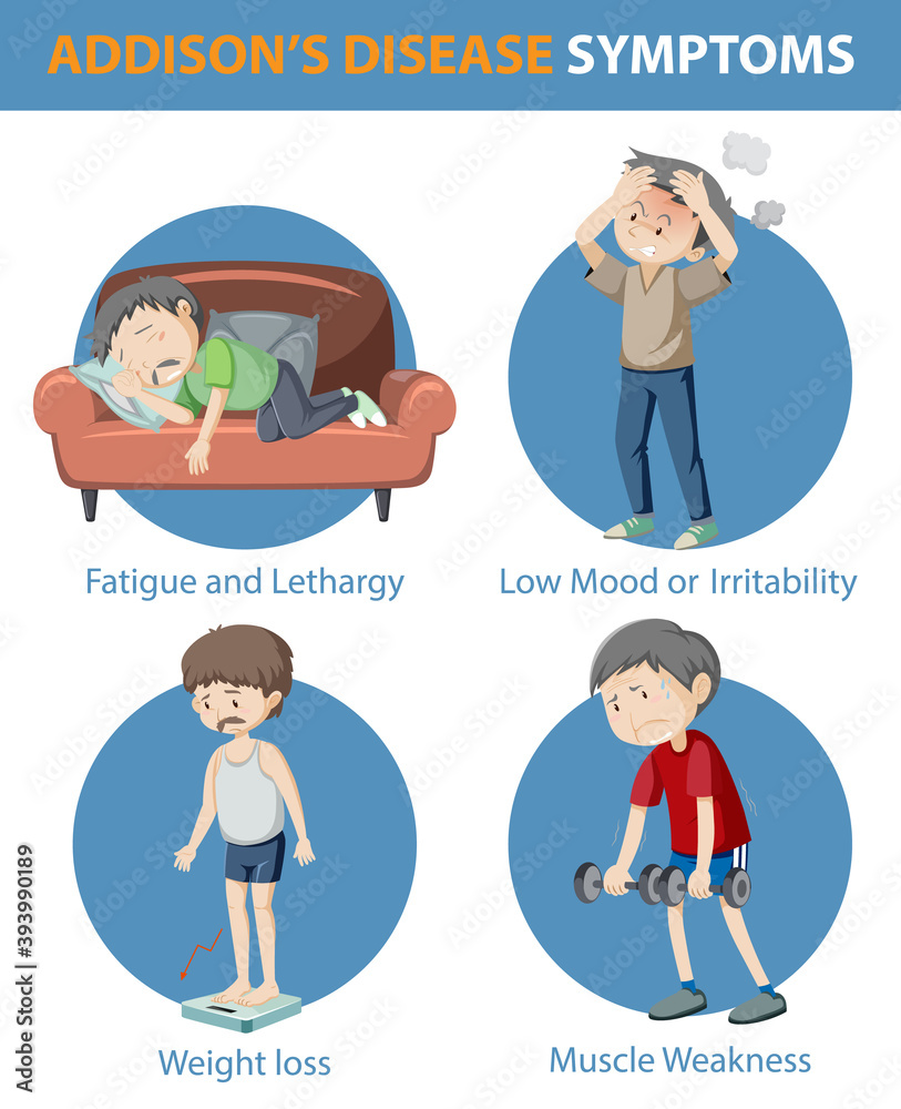 Medical infographic of Addison's disease symptoms Medical infographic of Addison's disease symptoms