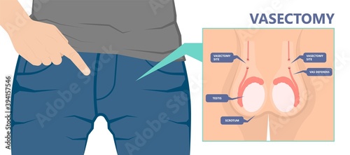 Testicular Disorder men vas pus tube male pain cyst test exam self cord vein sperm Acute blood semen tract penis viral virus tumor fluid testes pelvic sexual penile trauma system prostate testis