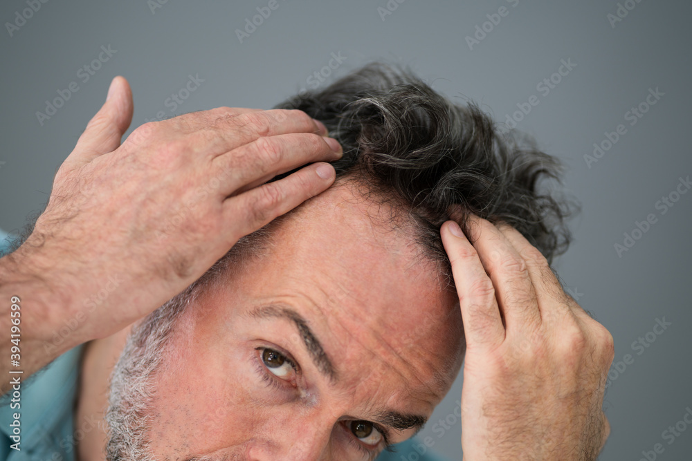 Fototapeta premium Man Checking His Hair Loss