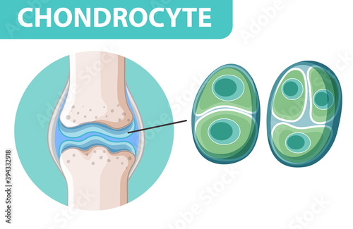 Informative poster of chondrocyte photo