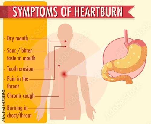 Symptoms of heartburn information infographic