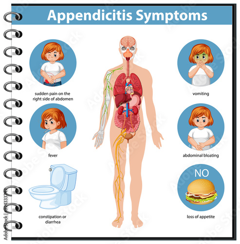 Appendicitis Symptoms information infographic