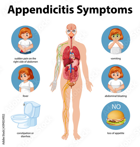 Appendicitis Symptoms information infographic