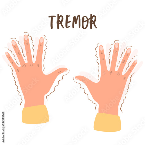 Flat vector illustration of a tremor. Trembling in the hands-symptoms of various mental disorders, panic, fear, Parkinson's disease. Isolated design on a white background.