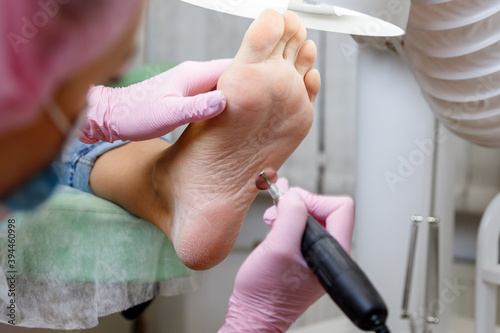 Professional hardware pedicure using electric machine. Patient on medical pedicure procedure with abrasive disc at home studio