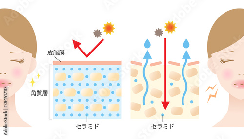 セラミド　乾燥肌　断面図　女性　ビフォアアフター