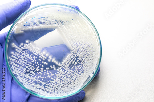 Canvas Print Pichia is a genus of yeasts in the family Saccharomycetaceae under the microscope for education