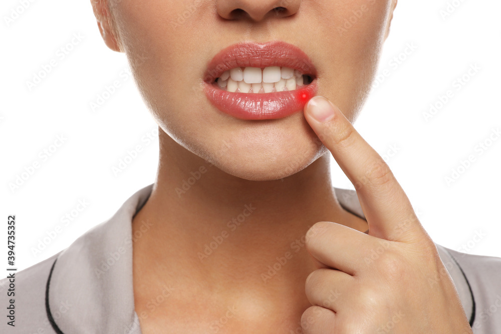 Obraz premium Woman with herpes touching lip on white background, closeup