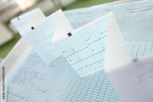 ECG line on paper electrocardiography in a clinical room