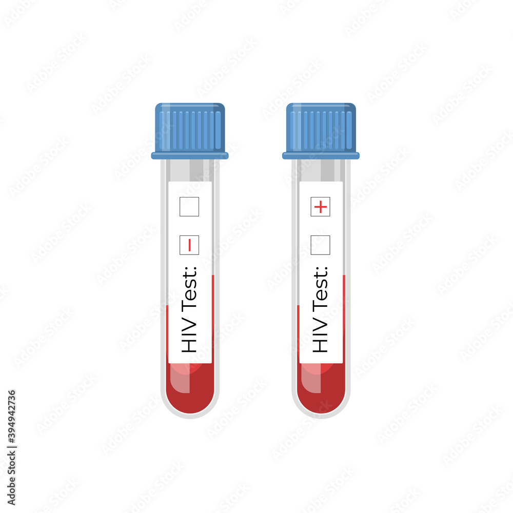 Test tubes for HIV with blood with a positive and negative result. The world AIDS day. HIV, blood test, virus, AIDS. Test tubes for HIV with blood with a positive and negative result. The world AIDS day. HIV, blood test, virus, AIDS.